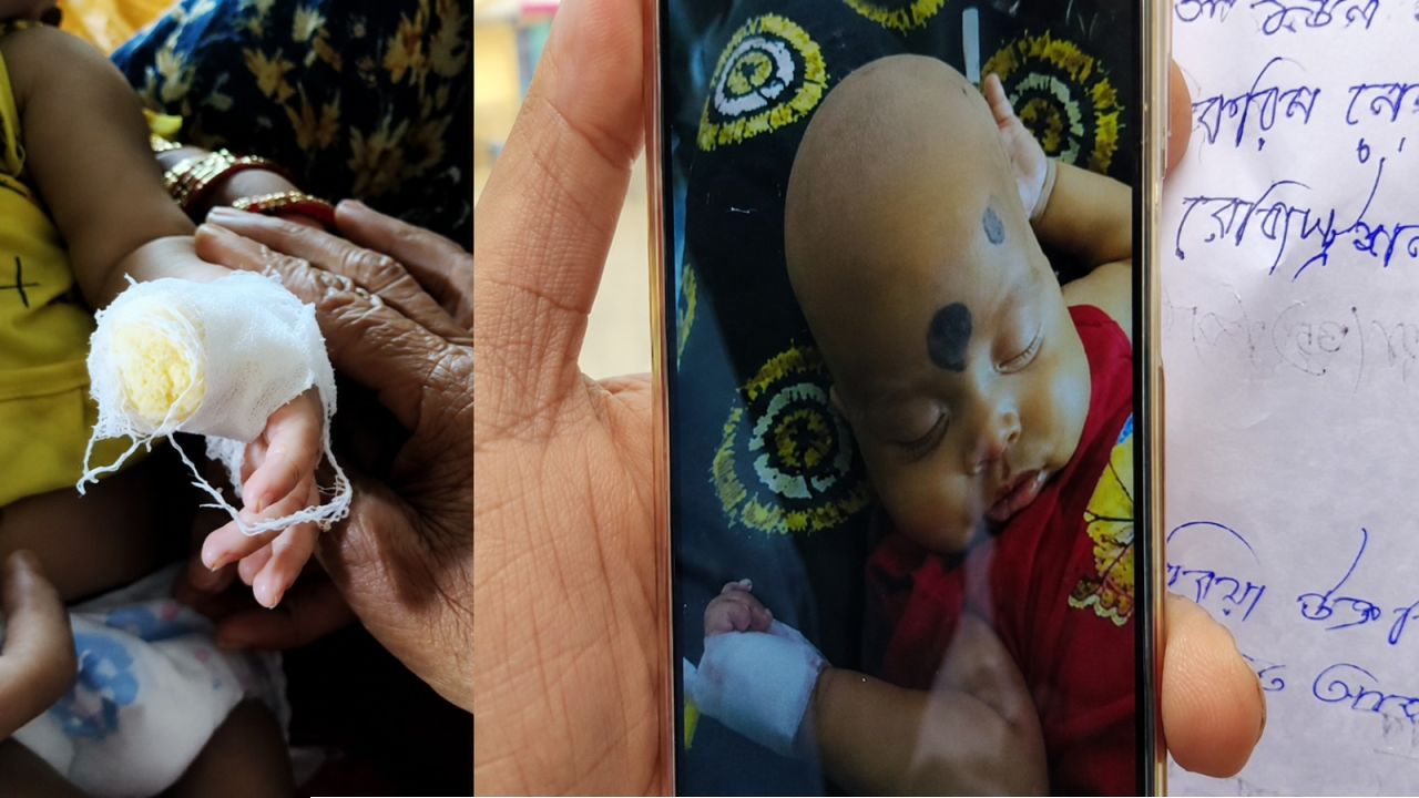 চেয়ারে বসে রইলেন নার্স, স্যালাইনের চ্যানেল খুলতে গিয়ে আড়াই মাসের শিশুর আঙুলই কেটে বাদ দিলেন ওয়ার্ড বয়!